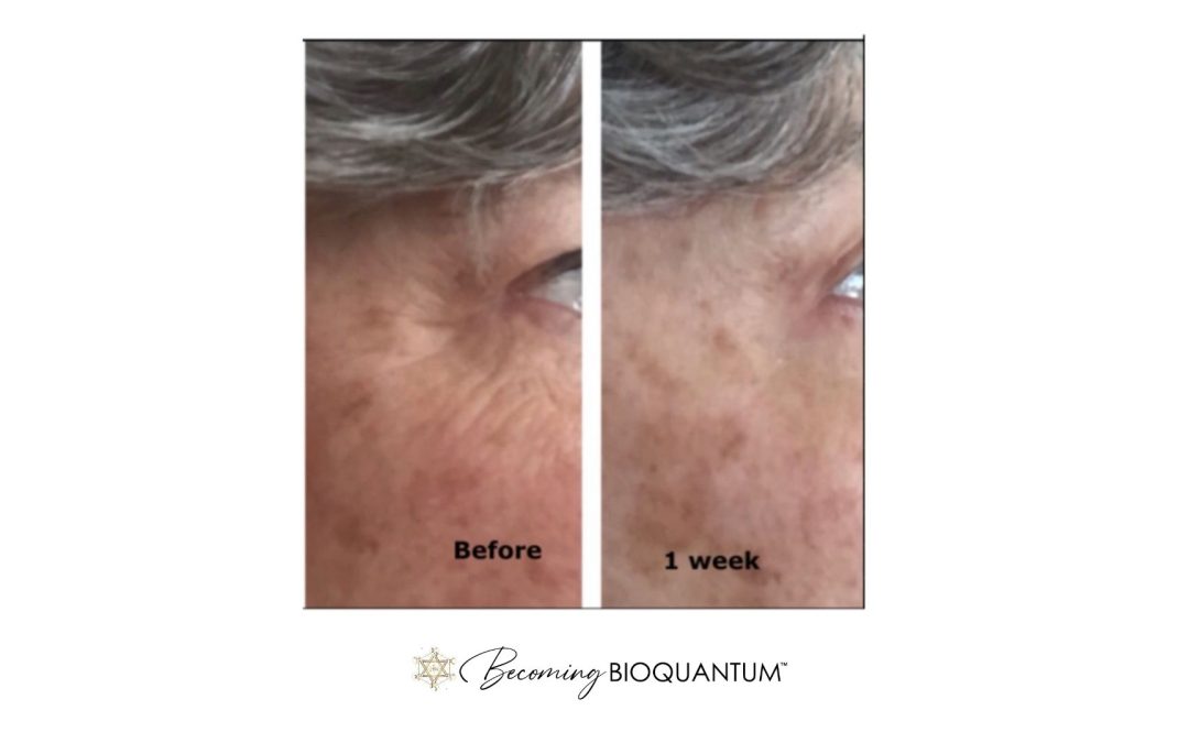 How to Take the Perfect Before & After Picture to See If Your Skincare Is Working